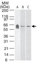 Anti-HTR3A Rabbit Polyclonal Antibody