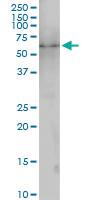 Anti-PKNOX2 Rabbit Polyclonal Antibody