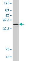 Anti-PCTP Mouse Polyclonal Antibody