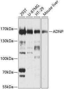 Anti-ADNP antibody