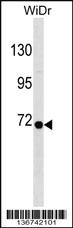 Anti-RPN1 Rabbit Polyclonal Antibody