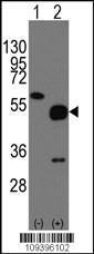 Anti-NPTX2 Rabbit Polyclonal Antibody (Biotin)