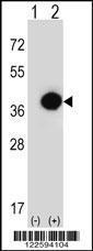 Anti-PHYH Rabbit Polyclonal Antibody (PE (Phycoerythrin))