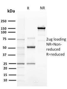 SDS-PAGE analysis of Anti-Cyclin E Antibody [CCNE1/2460] under non-reduced and reduced conditions; showing intact IgG and intact heavy and light chains, respectively. SDS-PAGE analysis confirms the integrity and purity of the antibody.