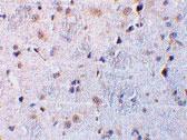 Anti-C1QTNF7 Rabbit Polyclonal Antibody