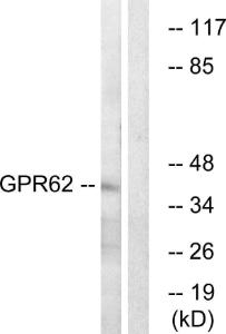 Western blot analysis of lysates from COLO cells using Anti-GPR62 Antibody. The right hand lane represents a negative control, where the antibody is blocked by the immunising peptide