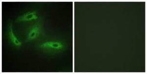 Immunofluorescence analysis of HeLa cells using Anti-CDKL4 Antibody. The right hand panel represents a negative control, where the Antibody was pre-incubated with the immunising peptide