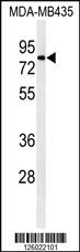 Anti-ERRFI1 Rabbit Polyclonal Antibody