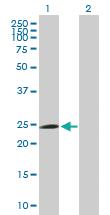 Anti-FBXO42 Mouse Polyclonal Antibody