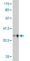 Anti-RFC3 Mouse Monoclonal Antibody [clone: 1C6]