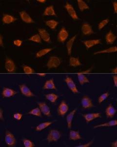 Immunofluorescence analysis of L929 cells using Anti-CAMSAP1 Antibody (A306493) at a dilution of 1:100 DAPI was used to stain the cell nuclei (blue)