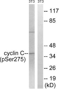 Western blot analysis of lysates from NIH/3T3 cells treated with UV 15' using Anti-Cyclin C (phospho Ser275) Antibody. The right hand lane represents a negative control, where the antibody is blocked by the immunising peptide