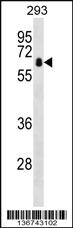 Anti-ZBTB7B Rabbit Polyclonal Antibody