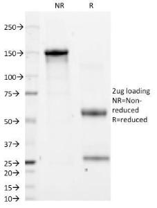 SDS-PAGE analysis of Anti-CD11a Antibody [CRIS-3] under non-reduced and reduced conditions; showing intact IgG and intact heavy and light chains, respectively. SDS-PAGE analysis confirms the integrity and purity of the antibody