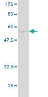 Anti-CA1 Mouse Monoclonal Antibody [clone: 1E11]