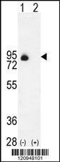 Anti-ENG Rabbit Polyclonal Antibody (Biotin)