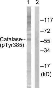 Anti-Catalase