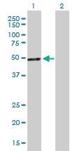 Anti-PCOLCE Mouse Polyclonal Antibody