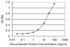 Anti-ZNF263 Mouse Monoclonal Antibody [clone: 3C9]