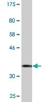 Anti-GPR161 Mouse Monoclonal Antibody [clone: 1B2]