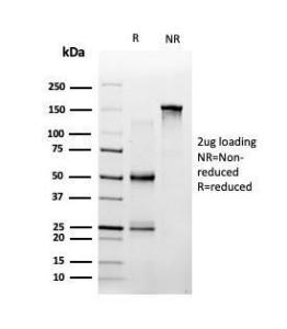 SDS-PAGE analysis of Anti-SPI-C Antibody [PCRP-SPIC-2C5] under non-reduced and reduced conditions; showing intact IgG and intact heavy and light chains, respectively. SDS-PAGE analysis confirms the integrity and purity of the antibody