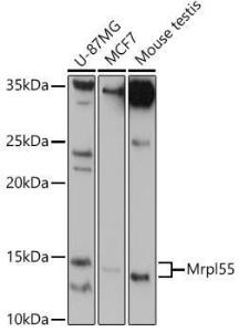 Western blot analysis of extracts of various cell lines, using Anti-MRPL55 Antibody (A305545) at 1:1,000 dilution. The secondary antibody was Goat Anti-Rabbit IgG H&L Antibody (HRP) at 1:10,000 dilution.