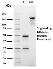 Anti-Cyclin E antibody