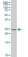 Anti-GSTO2 Mouse Polyclonal Antibody