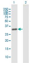 Anti-ZBTB49 Mouse Polyclonal Antibody