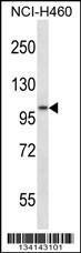 Anti-ADAM8 Rabbit Polyclonal Antibody (Biotin)