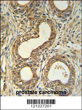 Anti-Roundabout 4 Rabbit Polyclonal Antibody (AP (Alkaline Phosphatase))