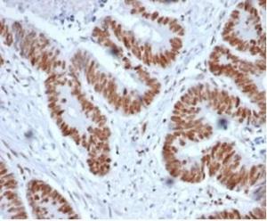 Immunohistochemical analysis of formalin-fixed, paraffin-embedded human colon tissue using Anti-MSH2 Antibody [MSH2/6852]