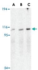 Anti-ERN1 Rabbit Polyclonal Antibody