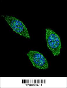 Anti-CSF2 Rabbit Polyclonal Antibody (FITC (Fluorescein Isothiocyanate))