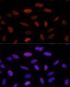 Anti-ADNP antibody