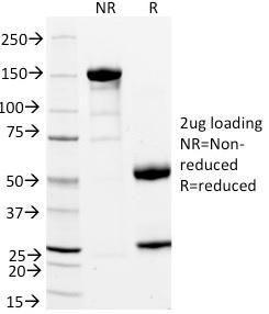 SDS-PAGE analysis of Anti-CD11a Antibody [DF1524] under non-reduced and reduced conditions; showing intact IgG and intact heavy and light chains, respectively. SDS-PAGE analysis confirms the integrity and purity of the antibody