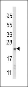 Anti-NQO2 Rabbit Polyclonal Antibody (Biotin)