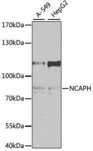 Antibody anti-NCAPH 100 µl