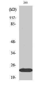 Western blot analysis of Jurkat cells using Anti-EFNA1 Antibody