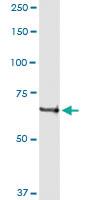 Anti-ACOX2 Polyclonal Antibody Pair