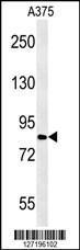 Anti-CPEB4 Rabbit Polyclonal Antibody (PE (Phycoerythrin))