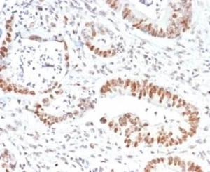 Immunohistochemical analysis of formalin-fixed, paraffin-embedded human colon tissue using Anti-MSH2 Antibody [MSH2/6852]