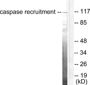 Anti-CARD6 antibody