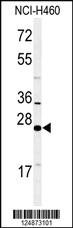 Anti-RAB27B Rabbit Polyclonal Antibody