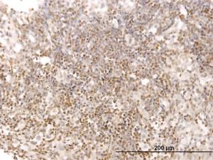 Anti-STAT5B Mouse Monoclonal Antibody [clone: 5D6]