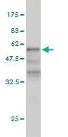 Anti-KLF6 Mouse Monoclonal Antibody [clone: 1A9]