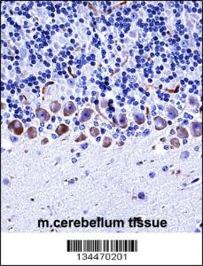 Anti-EPHA4 Rabbit Polyclonal Antibody (APC (Allophycocyanin))