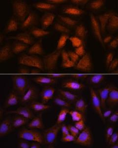 Antibody anti-NCAPH 100 µl