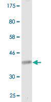 Anti-CACNA1I Mouse Monoclonal Antibody [clone: 2F5]