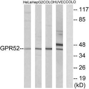 Antibody anti-GPR52 100 µg